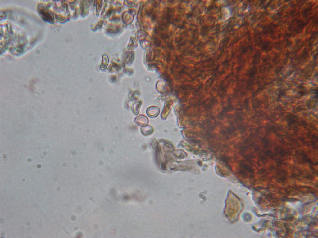 Su Salix caprea ...(Phellinus conchatus)